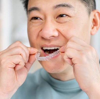 Man in light blue shirt putting in Invisalign aligner