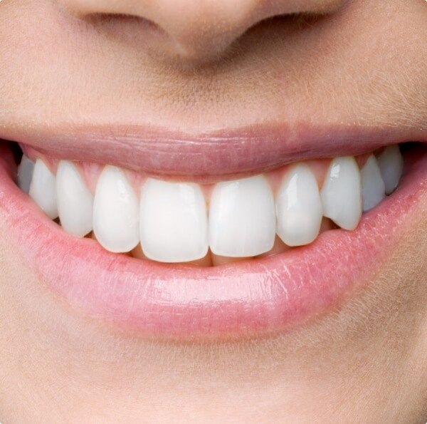 Closeup of healthy smile