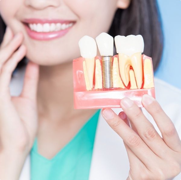 Smiling woman holding a dental implant model