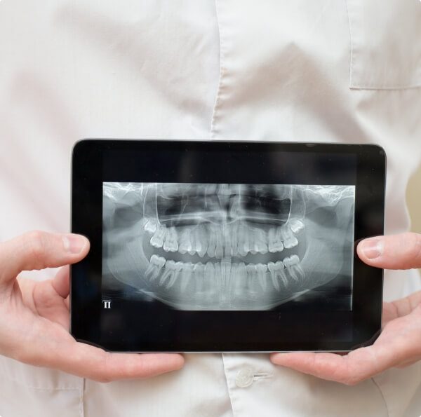 Digital x-rays on tablet computer