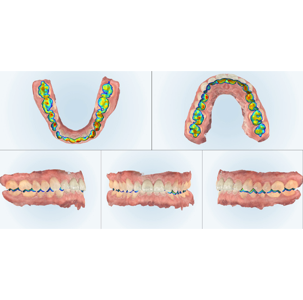 Images captured by a digital impression scanner