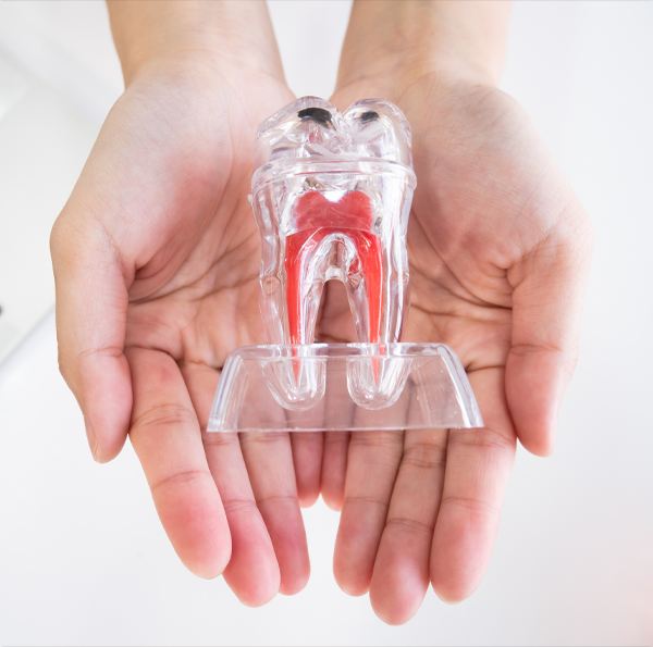 Model of the inside of a tooth used to explain root canal therapy