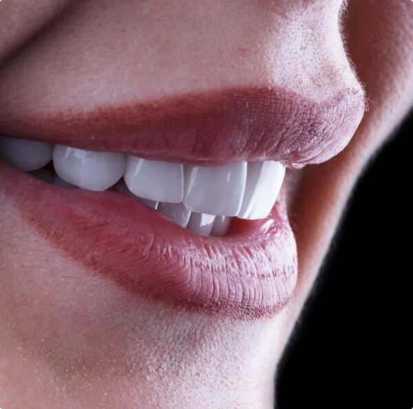 Closeup of flawless smile with veneers