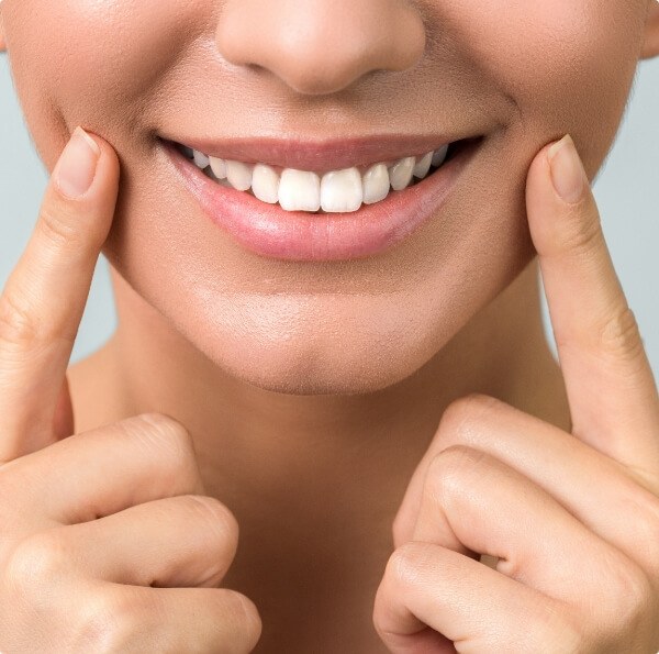 Closeup of flawless smile after makeover