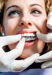 Align your smile with Invisalign treatment near Remington