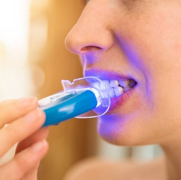 Patient using at home teeth whitening system