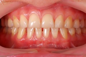 A close-up of a person’s mouth.