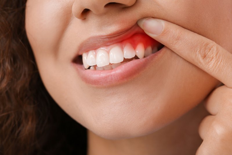 a patient with gum disease