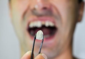 a person holding a dental crown that fell out of their mouth